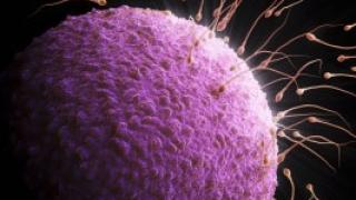 Мужское бесплодие. Причины, обследование, лечение