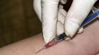 Все о реакции Манту