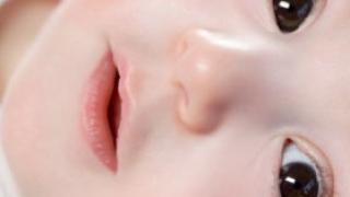 Угол зрения. Косоглазие у детей