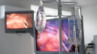 Бариатрическая операция. Кому и зачем? Интервью с хирургом